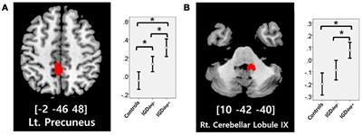 Subregions of the Anterior Cingulate Cortex Form Distinct Functional Connectivity Patterns in Young Males With Internet Gaming Disorder With Comorbid Depression